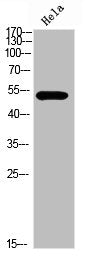 Phospho-TP53 (Ser366) Antibody