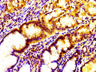 IL17D Antibody
