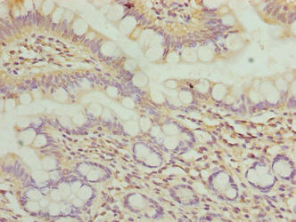 WDR66 Antibody