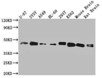 SPPL3 Antibody