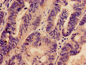 PREX1 Antibody