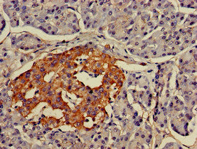 LMX1A Antibody