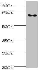 ATRIP Antibody
