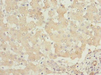 PHKB Antibody