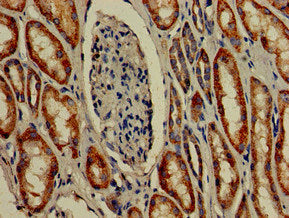 TMIGD2 Antibody