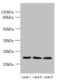 WDYHV1 Antibody