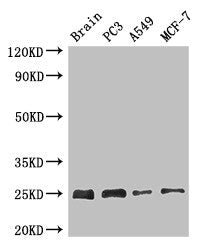 APOPT1 Antibody