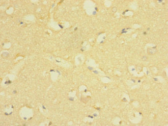 LRIG1 Antibody