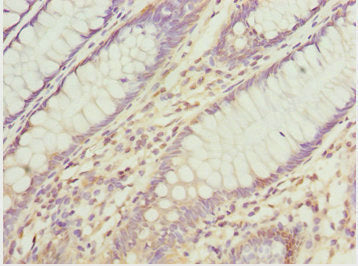 ATOH7 Antibody