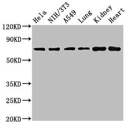ARHGAP18 Antibody