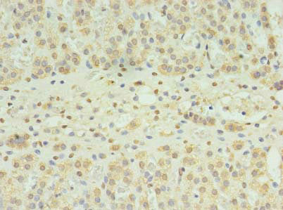 SLC22A24 Antibody