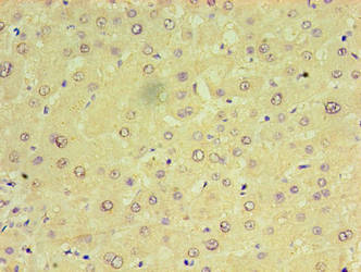 CHCHD4 Antibody