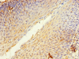 KIR3DL3 Antibody