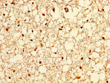 ZIC4 Antibody