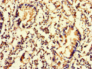 DNAAF3 Antibody