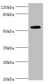 TSEN2 Antibody