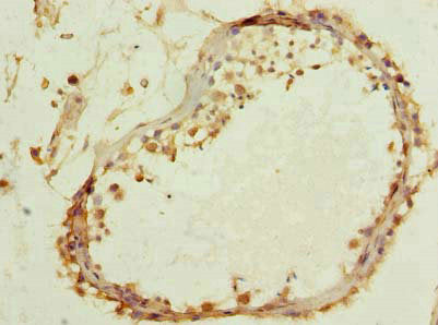 TTC16 Antibody