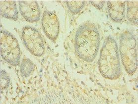 COQ8A Antibody