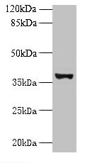 UBLCP1 Antibody