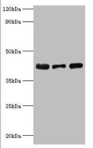 ST8SIA2 Antibody
