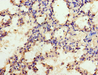 EZH1 Antibody