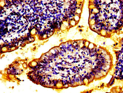 ABCC2 Antibody
