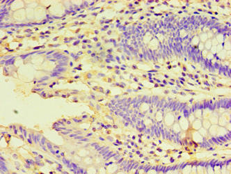 HSPBAP1 Antibody