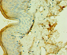 TCTN2 Antibody
