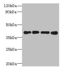 MAGEB18 Antibody