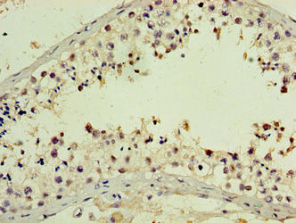PNMA5 Antibody