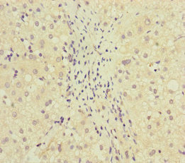 MCCC1 Antibody