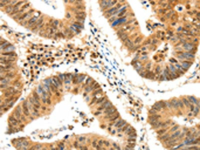 TERF2 Antibody