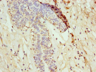 NANP Antibody