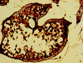 RAET1E Antibody