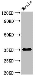 Metrnl Antibody