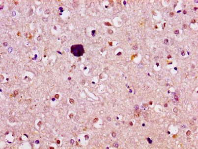 ATL1 Antibody