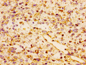 CCL17 Antibody