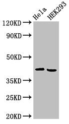 ARPC1A Antibody