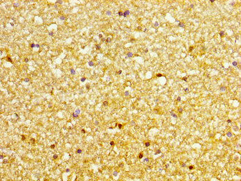 DVL3 Antibody