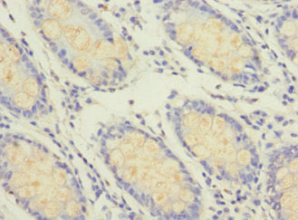 GFM2 Antibody
