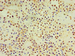 DACT3 Antibody