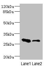 EAF2 Antibody