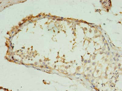 RMND5B Antibody
