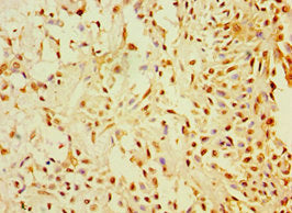 CALR3 Antibody