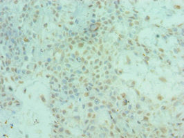 ALS2 Antibody