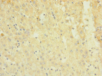 TRPM7 Antibody