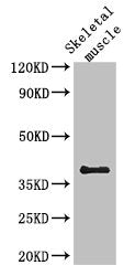 SLC29A1 Antibody
