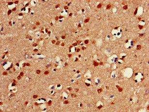 FOXC2 Antibody