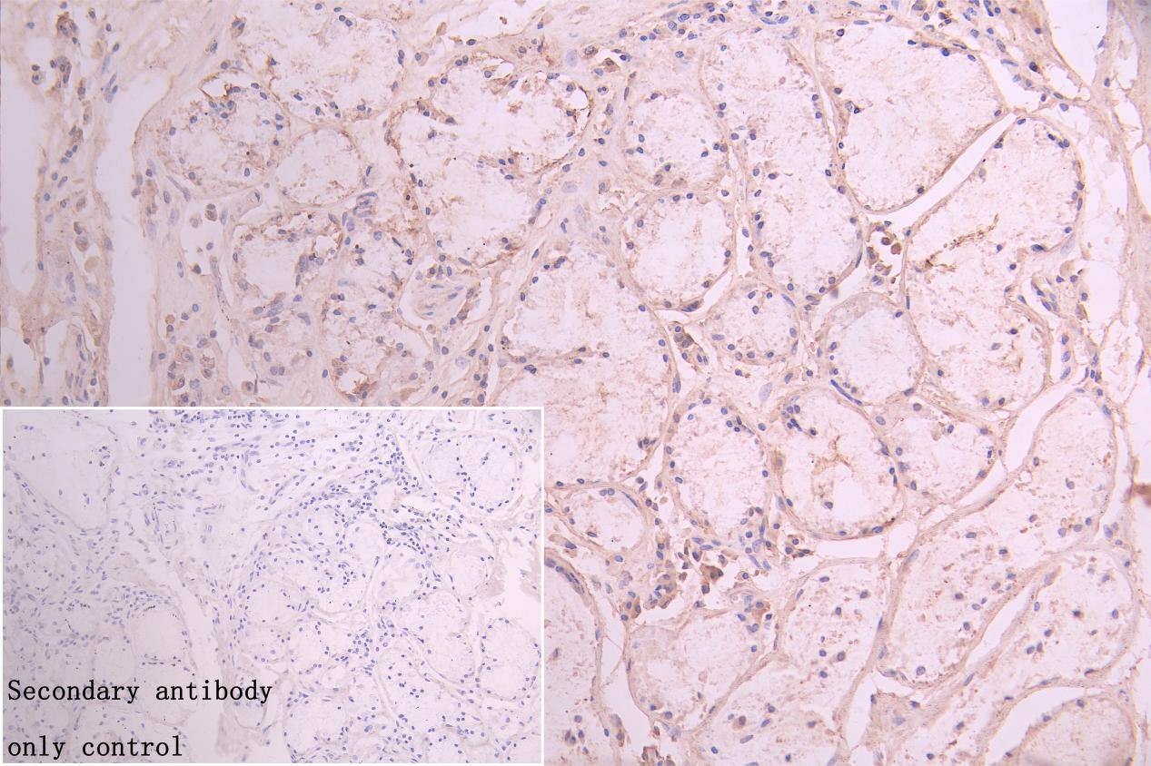 AKAP9 Antibody