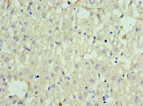 SOST Antibody